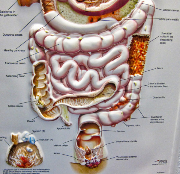 human colon