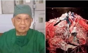 cancer survival advice